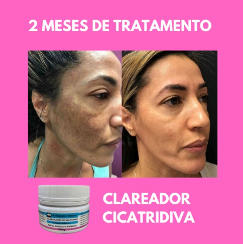 Resultado 3